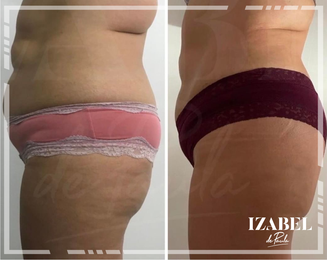 Barriga Fit crema - Imagen 2